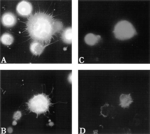 Fig. 5. Abnormal filopodia formation of WAS MKs after adhesion to poly-L-lysine. Cultured cells were pipetted onto poly-L-lysine–coated coverslips. After 30 minutes of adhesion, cells were fixed, permeabilized, and labeled as described in Fig 3. (A and B) Examination of a normal MK with a combination of filters allowing simultaneous visualization of vWF (TRITC), F-actin (FITC), and DNA (Hoechst). The normal MK displays long, thin, and numerous filopodia that contain F-actin, but not vWF, which remains localized in the center of the cell. In contrast, WAS MKs fail to extend long filopodia (C) or extend very short, but less numerous filopodia (D) than do normal MK. Examination of WAS MKs with a combination of filters was not interpretable because of the central localization of F-actin that overlaps with that of vWF and therefore was not shown in this figure.