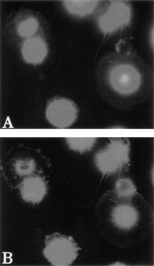 Fig. 6. Localization of WASP in normal MKs after adhesion on Poly-L-lysine. Examination of normal MKs was performed as described in Fig 5. MKs were labeled with anti-vWF polyclonal antibody (AMCA), phalloidin (FITC), and anti-WASP MoAb (TRITC) after 30 minutes of adhesion to poly-L-lysine–coated coverslips. Anti-vWF labeling (AMCA) allowed the localization of MKs. Unlike vWF, WASP is localized in filopodia (A) with the same topography as F-actin (B).