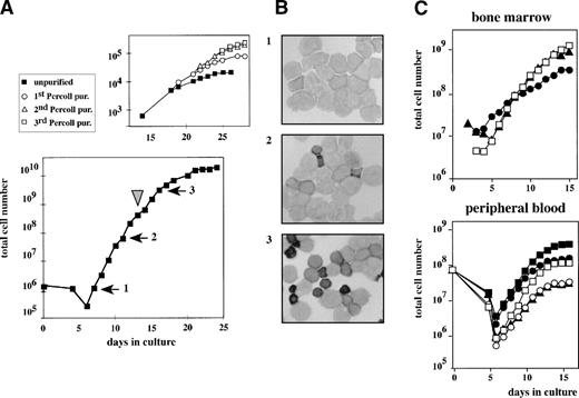 Fig. 1. Outgrowth of erythroid progenitors from neonatal cord blood, human bone marrow, or peripheral blood. (A) CD34+cells isolated from neonatal cord blood were cultured in CFU-E medium complemented with Epo, SCF, IGF-I, and Dex (lower part). Cell density was kept at 1.5 to 3 × 106 cells/mL and total cell numbers were enumerated at the times indicated. At day 14 (arrowhead), immature low-density cells were purified from the mass culture using Percoll 1.072 g/mL and reseeded (top part). This procedure was repeated several times. (B) At day 8 (1), day 12 (2), and day 17 (3) after initiating the culture, cells were cytocentrifuged onto slides and stained with histochemical dyes plus a specific stain for hemoglobin that makes hemoglobinized cells appear dark in this figure.22 Numbers of panels correspond to numbered arrows in (A), indicating the time of aliquot removal. (C and D) Ficoll-purified cells from bone marrow (3 healthy donors) or from peripheral blood (5 untreated, healthy donors) were cultivated as described in the legend to (A) and cumulative cell numbers were calculated. In case of the peripheral blood-derived cells, apoptotic cells and lymphocytes were removed by centrifugation through Percoll 1.072 g/mL at days 4 and 6 of culture.
