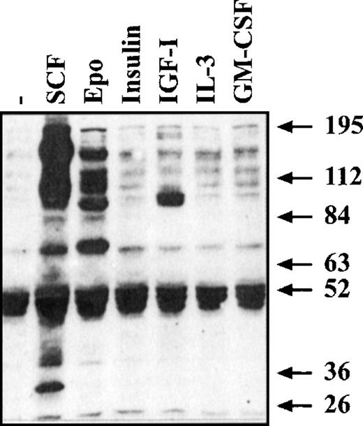 Fig. 2. Tyrosine phosphorylation induced by activation of receptors for growth factors and cytokines. Erythroid progenitors were withdrawn from growth factors overnight and subsequently stimulated for 10 minutes with the cytokines indicated, using 10-fold higher concentrations than used in liquid cultures. Cell lysates were separated on acrylamide gels and subjected to Western blot analysis using the antiphosphotyrosine antibody 4G10. Arrows indicate the position of the size markers used.