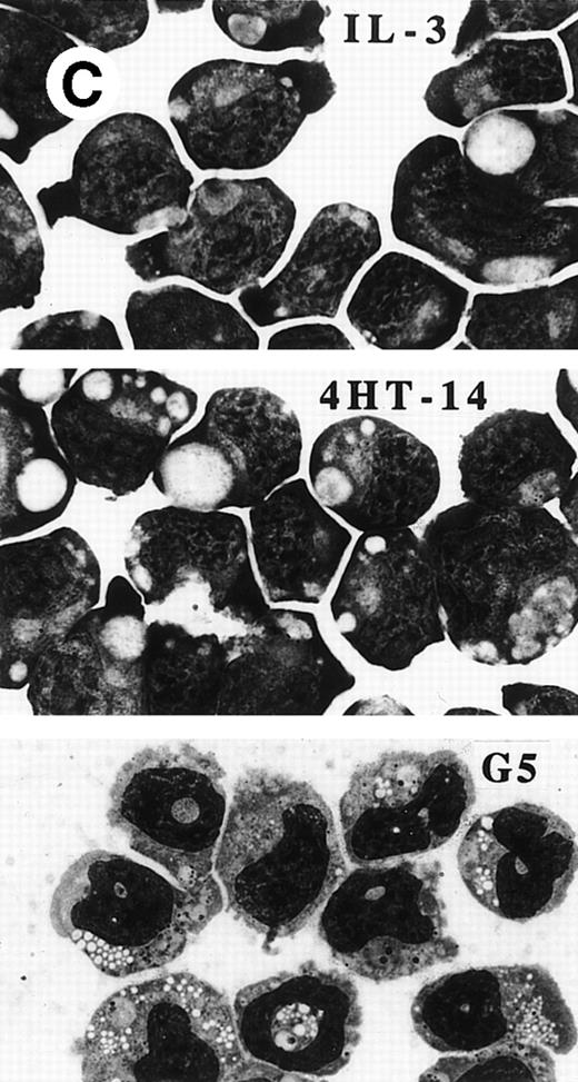 Fig. 8. PU.1-ER(T) induces MPO RNA, but does not induce terminal granulopoiesis in 32D cl3 myeloblasts. (A) Ten micrograms of pB4TKCAT was transfected into NIH 3T3 cells with 10 μg pCMV-Pip and 10 μg of pPGK-PU.1 or pPGK-PU.1-ER(T) and was cultured with or without 100 nmol/L 4HT (lanes 1 through 4). pB4TKCAT was similarly transfected with pCMV-Pip and pPGK-AS-PU.1, which expresses an antisense PU.1 RNA, and cultured with 4HT (lane 5). CAT assays performed 48 hours after transfection are shown. (B) Total cellular protein extracts prepared from 32D cl3 cells and from two puromycin-resistant subclones transduced with the BabePuro-PU.1-ER(T) retroviral vector were subjected to Western blotting using an ER antisera. The location of PU.1-ER(T) is indicated. (C) Cytospins were prepared from 32D-PU.1-ER(T) cells in IL-3, in IL-3 and after exposure to 4HT for 14 days, and after transfer from IL-3– to G-CSF–containing media for 5 days. The cytospins were subjected to Wright’s-Giemsa staining. (D) Total cellular RNAs were prepared from 32D-PU.1-ER(T) cells in IL-3 after exposure to 4HT for 0, 1, or 2 days. These RNAs were subjected to Northern blotting for MPO RNA (top panel). The integrity of the RNA samples was assessed by ethidium bromide staining (bottom panel).