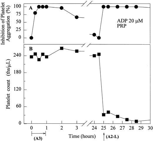 Fig. 2. The effect of the infusion of A3 (0.4 μg/kg/min for 1 hour) followed 24 hours later by 10 μg/kg IV bolus of A2-L on ex vivo platelet aggregation in PRP stimulated with 20 μmol/L ADP (A) and platelet count in whole blood (B) in ketamine-sedated chimpanzee A-264. (•) Inhibition of platelet aggregation as measured by a change in light transmittance (PPP 100%) under stirring conditions (1,100 rpm) at 37°C in Biodata Platelet Aggregation Profiler. (▪) Platelet count measured in whole blood using a Coulter Cell Counter.