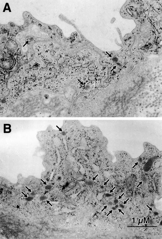Fig. 6. The number of Weibel-Palade bodies per HUVEC is less in endothelial cells from preterm infants. This figure is representative of the data in Fig 5. (A) is from a 23-week gestation infant and (B) is from a term infant. Here there are 4 to 5 times as many Weibel-Palade bodies (arrows) in the cytoplasm of the term infant compared with the preterm infant.