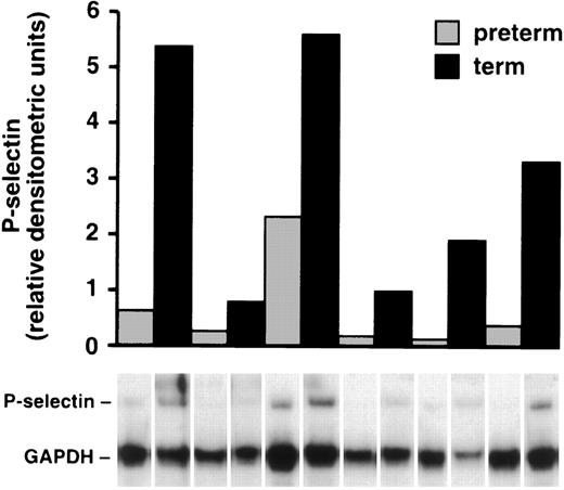 Fig. 7. P-selectin mRNA is diminished in HUVECs from preterm cords. P-selectin mRNA was quantitated in each sample with an RNAse protection assay (see Materials and Methods) and normalized to GAPDH mRNA in the same sample. The ratio of the relative intensities of P-selectin mRNA compared with GAPDH mRNA is shown in the bar graph with the corresponding lane below. The combined relative densitometric units in the term infants was 4.6× greater than in the preterm infants (P = .016).