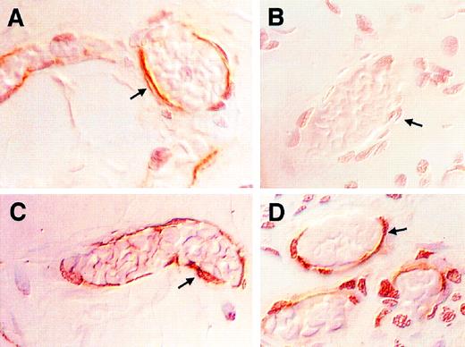 Fig. 2. Newborn rats have a defect in expression of P-selectin on endothelial cells after an inflammatory stimulus. The photomicrographs in this figure are of samples collected 30 minutes after an intraperitoneal injection of thioglycollate and are representative of the 11 rats studied in each group. Postcapillary mesenteric venules were identified by their morphology. The sections were viewed with Nomarski differential interference contrast optics. All four panels were magnified 500×. (A and B) P-selectin expression. P-selectin expression was detected with the MoAb PB1.3. (A) is representative of mesenteric venules in the adult rat. The arrows demonstrate positive brown immunostaining of endothelial cells lining the vessels. (B) is representative of the newborn rat. The arrow points to endothelial cells lining newborn mesenteric venules that did not stain. (C and D) PECAM-1 expression. (C) is a section of adult mesentery and (D) is a section of newborn mesentery. Positive brown immunostaining for PECAM-1 is demonstrated covering the full height of the cytoplasm of endothelial cells (arrows).