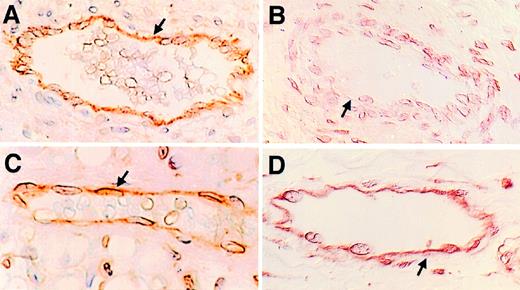 Fig. 3. Expression of P-selectin is developmentally regulated in humans. Mesentery was collected during the autopsy of individuals of varying age and processed as in Fig 2. The sections were viewed with Nomarski differential interference contrast optics. All four panels are magnified 165×. (A and B) P-selectin expression. P-selectin expression was detected with the MoAb S12. (A) is from a term infant who died because of a congenital heart defect and (B) from a 22-week gestation infant delivered prematurely because of an incompetent cervix. There is immunostaining for P-selectin on mesenteric endothelial cells of the term infant (arrows), but no immunostaining was detected on the endothelial cells from the 22-week gestation infant. The arrow in (B) points to endothelial cells lining newborn mesenteric vessels that did not stain. (C and D) PECAM-1 expression: These sections are from the same tissue blocks as in (A) and (B). (C) is a section of mesentery from the term infant and (D) is from the 22-week gestation infant. The arrows in both figures indicate endothelial cells immunostained for PECAM-1.
