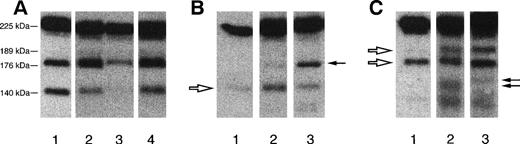 Fig. 3. (A) Autoradiographic image of vWF subunit (225 kD) and fragments (189, 176, and 140 kD) detected with a pool of MoAbs directed against different epitopes of vWF. Lane 1, normal plasma pool; lane 2, fragmentation of the protein in a recurrent patient (R7) during the acute phase; lane 3, the same patient at remission; lane 4, increased fragmentation in a patient with the familial form (F64#5) collected during remission. (B) Autoradiographic image obtained using MoAb anti N terminus (that labels in normal plasma the 140-kD fragment, white arrow). Lane 1, normal plasma pool; lane 2, a recurrent patient (R29, acute phase) showing an abnormal band at the 176-kD position (black arrow); lane 3, a patient with the familial form at remission (F45#2) with a similar abnormal fragment. (C) Representative image obtained using MoAb anti-C terminus (that labels in normal plasma 189- and 176-kD fragments, white arrows). Lane 1, normal plasma pool; lane 2, a recurrent patient (R12) showing both normal fragments and an abnormal fragment as shown by the appearance of a band of 140 kD (black arrow, not detected in normal plasma with this MoAb); lane 3, a patient with the familial form (F108#24 at remission) showing an abnormal band at 150 kD (black arrow) in addition to normal fragments.