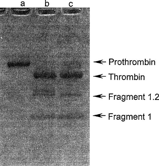 Fig. 3. SDS-PAGE analysis of prothrombin activation. Prothrombin (5 μg) was activated with trocarin or human factor Xa (5 ng each) in the presence of Ca2+ ions (5 mmol/L), 9:1 PC:PS phospholipid vesicles (100 μmol/L), and factor Va (10 nmol/L) at 37°C for 4 hours. The reaction mixture was loaded on a nonreducing 4% to 20% gradient gel. Untreated prothrombin (lane a), cleavage products of prothrombin by trocarin (lane b), and factor Xa (lane c) were electrophoresed according to Laemmli.15