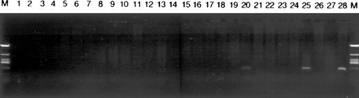 Fig. 3. Chromosomal assignment of the human EPCR gene. A human monochromosomal somatic cell hybrid DNA panel and controls were amplified by PCR to determine the chromosomal location of the EPCR gene. The exon-specific primers EPCR-3 and EPCR-4 (Table 1) were used and the products were separated on a 1% agarose gel. The templates in lanes 1 to 24 were mouse/human or hamster/human somatic cell hybrids containing chromosomes 1 to 22, X and Y chromosomes, respectively. Lanes 25 and 28 were human genomic DNA samples; one was provided with the panel (lane 25) and one was our internal control (lane 28). Lanes 26 and 27 were mouse and hamster genomic DNA, respectively. The marker lane (M) is pHC624/Taq I-pMJ/Nci I (Advanced Biotechnologies, Leatherhead, UK). This contains fragments of 1444, 696, 475, 411, 358, 352, 212, and 96 bp (the 358- and 352-bp fragments comigrate).