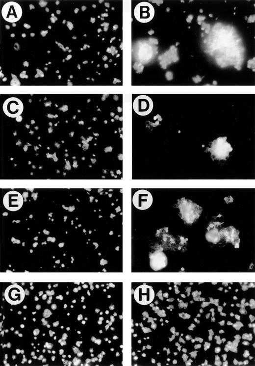 Fig. 2. 4N1K and TS1 induce the aggregation of platelets adherent to immobilized collagen. Washed platelets were allowed to adhere on immobilized collagen (10 μg/mL). After 60 minutes, platelets were fixed with 1% paraformadehyde, permeabilized with 0.1% Triton X-100, and stained with rhodamine-phalloidin. Treatments added 15 minutes before plating were (A) no treatment; (B) 4N1K (50 μmol/L); (C) 4NGG (50 μmol/L); (D) TS1 (50 μg/mL); (E) apyrase (10 U/mL); (F) apyrase (10 U/mL) plus 4N1K (50 μmol/L); (G) PGE1 (1 μmol/L); (H) PGE1 (1 μmol/L) + 4N1K (50 μmol/L).