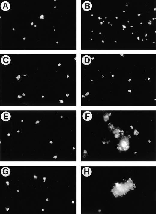 Fig. 3. Specificity of the effect of 4N1K and TS1 on platelet aggregation on collagen. Human platelets prepared as in Fig 2 were allowed to adhere to immobilized collagen after pretreatment for 15 minutes with (A) anti-2 MoAb, P1E6 (10 μg/mL) + 4N1K (50 μmol/L); or (B) B6H12 F(ab)2 (100 μg/mL) + 4N1K (50 μmol/L). For (C) through (H), mouse platelets were processed as for human platelets (see Materials and Methods). (C, E, and G) Platelets from IAP-deficient mice; (D, F, and G) platelets from wild-type mice. (C and D) 4NGG (50 μmol/L); (E and F) 4N1K (50 μmol/L); (G and H) human TS1 (50 μg/mL).