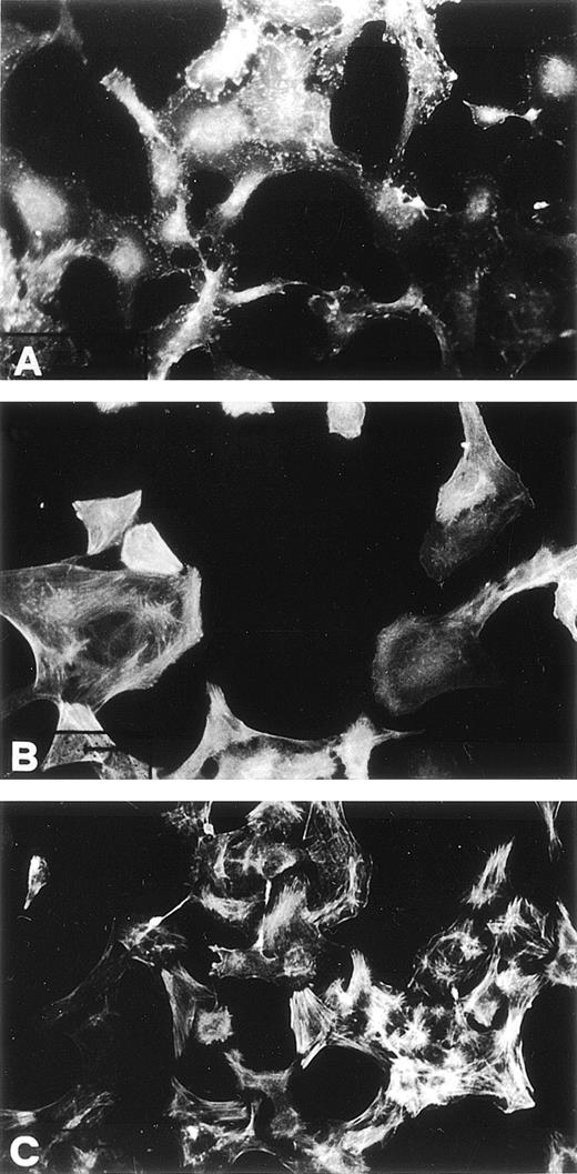 Fig. 2. Effect of pro-u-PA on actin cytoskeleton organization and on morphology of RSMC. Subconfluent (50% to 70%) cells were incubated in the absence (A) or in the presence of 1 nmol/L pro-u-PA for 30 (B) or 120 minutes (C). Actin filaments were visualized using FITC-coupled phalloidin as described.
