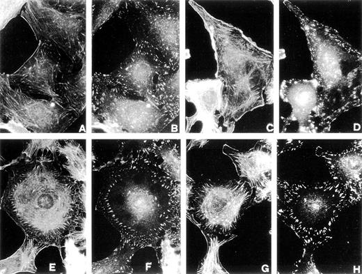 Fig. 3. Effect of pro-u-PA on actin cytoskeleton (A, C, E, G, I, K, M, O, Q, and S) and vinculin distribution (B, D, F, H, J, L, N, P, R, and T) on RSMC. Cells were incubated in the absence (A and B) or in the presence of 1 nmol/L pro-u-PA for 5 minutes (C and D), for 10 to 15 minutes (E, F, G, H, I, and J), for 30 minutes (K, L, M, N, O, P, Q, and R), or for 120 minutes (S and T). The cells were then fixed and double-stained with fluorescein-conjugated phalloidin to visualize actin filaments and with antibody against vinculin, which was visualized with a rhodamine-conjugated secondary antibody.