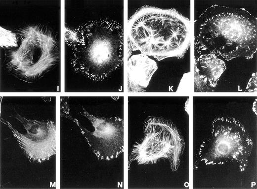 Fig. 3. Effect of pro-u-PA on actin cytoskeleton (A, C, E, G, I, K, M, O, Q, and S) and vinculin distribution (B, D, F, H, J, L, N, P, R, and T) on RSMC. Cells were incubated in the absence (A and B) or in the presence of 1 nmol/L pro-u-PA for 5 minutes (C and D), for 10 to 15 minutes (E, F, G, H, I, and J), for 30 minutes (K, L, M, N, O, P, Q, and R), or for 120 minutes (S and T). The cells were then fixed and double-stained with fluorescein-conjugated phalloidin to visualize actin filaments and with antibody against vinculin, which was visualized with a rhodamine-conjugated secondary antibody.