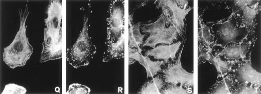 Fig. 3. Effect of pro-u-PA on actin cytoskeleton (A, C, E, G, I, K, M, O, Q, and S) and vinculin distribution (B, D, F, H, J, L, N, P, R, and T) on RSMC. Cells were incubated in the absence (A and B) or in the presence of 1 nmol/L pro-u-PA for 5 minutes (C and D), for 10 to 15 minutes (E, F, G, H, I, and J), for 30 minutes (K, L, M, N, O, P, Q, and R), or for 120 minutes (S and T). The cells were then fixed and double-stained with fluorescein-conjugated phalloidin to visualize actin filaments and with antibody against vinculin, which was visualized with a rhodamine-conjugated secondary antibody.