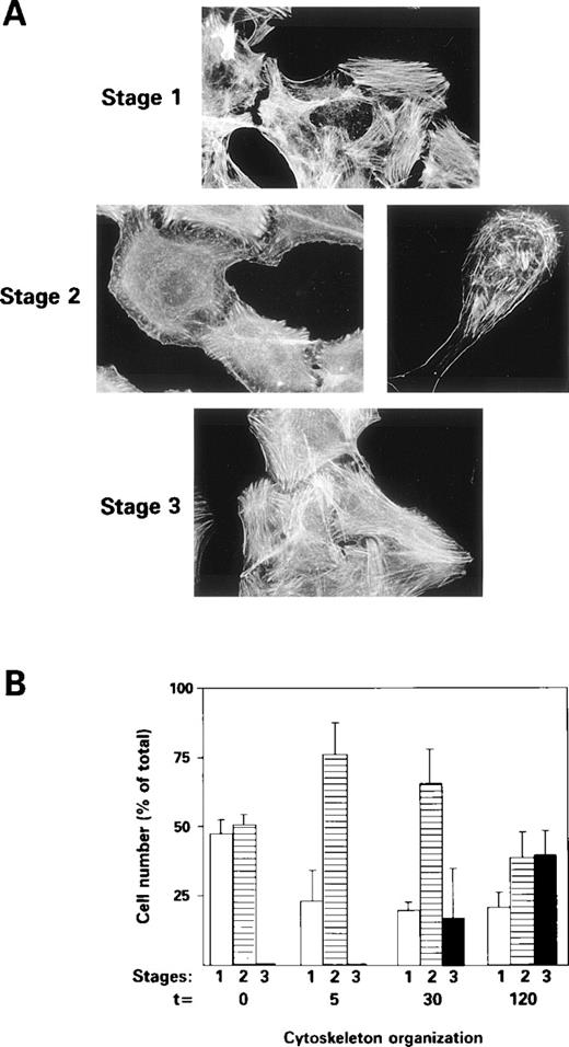 Fig. 4. Pro-u-PA–induced actin cytoskeleton reorganization in RSMC. Cells were stimulated with 1 nmol/L pro-u-PA for different time periods at 37 °C, after which cells were fixed and stained with fluorescein-conjugated phalloidin. Quantification of actin cytoskeleton reorganization was performed by taking photographs at low magnification and by counting cells in each stage of cytoskeleton organization. (A) Examples of these stages are given (for more details see the text) briefly. Stage 1 corresponds to resting cells that exhibit stress fibers. Stage 2 coresponds to cells showing a reorganization of cytoskeleton: a decrease of stress fibers content, membrane ruffling, actin ring or actin semi-ring with elongated cell shape characteristic of motile cells. Stage 3 corresponds to cells that reform stress fibers but with a vinculin distribution different from that of cells in stage 1 (see Fig 3). (B) The percentage of cells exhibiting actin cytoskeleton reorganization was recorded after incubation for 5, 30, and 120 minutes with pro-u-PA.