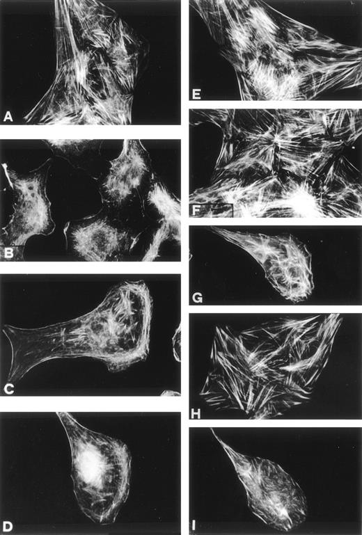 Fig. 5. Effects of chymotrypsin-cleaved su-PAR and peptide 1 on actin cytoskeleton on RSMC. Cells were incubated in the absence of chemoattractant (A) or with 10 pmol/L C-su-PAR for 5 (B) or 30 minutes (C) or with 1 pmol/L peptide 1 for 30 minutes. Effects of BPT on the pro-u-PA–induced actin cytoskeleton reorganization on RSMC. Cells were untreated or pretreated with 50 ng/mL pertussis toxin or with 50 ng/mL of mutated pertussis toxin for 6 hours; the cells were then incubated with or without 1 nmol/L pro-u-PA in the absence or in the presence of toxin. (A) Untreated and unstimulated cells. (E) Unstimulated cells treated with 50 ng/mL pertussis toxin. (F) Unstimulated cells treated with 50 ng/mL mutated pertussis toxin. (G) Untreated cells stimulated for 30 minutes with 1 nmol/L pro-u-PA. (H) Pertussis toxin (50 ng/mL) -treated cells stimulated for 30 minutes with 1 nmol/L pro-u-PA. (I) Mutated pertussis toxin (50 ng/mL)- treated cells stimulated for 30 minutes with 1 nmol/L pro-u-PA. Actin filaments were visualized using fluorescein-conjugated phalloidin.
