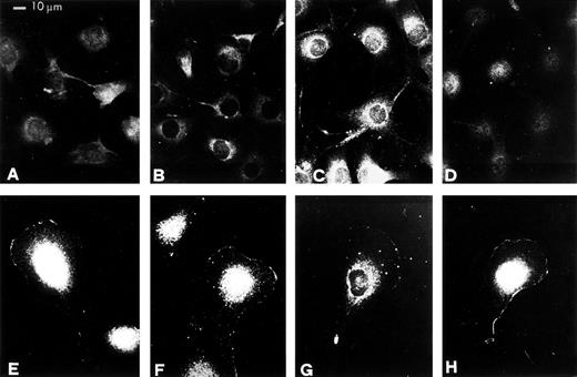 Fig. 7. Relocations of u-PAR, VNR, β1, and c-Src proteins to membranes at the leading edge of migrating RSMC in response to pro-u-PA. Subconfluent (50% to 70%) cultures were incubated in the absence (A, B, C, and D) or in the presence of 1 nmol/L pro-u-PA for 30 minutes (E, F, G, and H). The cells were then fixed and stained with antibodies against u-PAR (A and E), VNR (B and F), β1 (C and G), or c-Src (D and H).