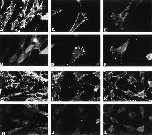 Fig. 8. Src is required for u-PA–dependent cell shape changes. Mouse 3T3 cells from Src−/− and wild-type mice were transfected with a human u-PAR cDNA. u-PAR–positive cells (determined by direct binding and immunofluorescence assays) were then supplemented with 10 nmol/L ATF (the amino terminal fragment of human u-PA) and incubated for 0 or 30 minutes at 37°C; at the end of the incubation, the cells were washed, stained with phalloidin (A, C, E, G, I, and K) or with antivinculin antibodies (B, D, F, H, J, and L), and viewed and photographed under the immunofluorescence microscope. From (A) to (F): Src+ cells incubated in the absence (A and B) or in the presence of 10 nmol/L ATF for 30 minutes (C, D, E, and F). From (G) to (L): Src−/− cells incubated in the absence (G and H) or in the presence of 10 nmol/L ATF for 30 minutes (I, J, K, and L).