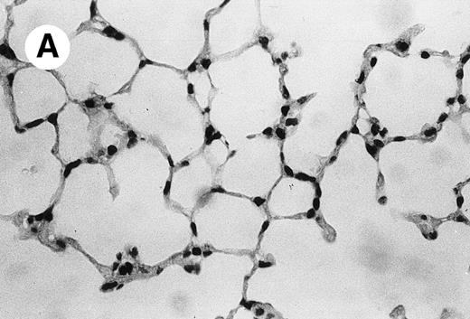 Fig. 4. Lung histopathology. Aspect of alveolar walls 60 minutes after IV injection of PBS (A) or 10 μg of MWReg30 (B); (C) 24 hours after IV injection of 10 μg of MWReg30; (D) vascular engorgement of septal capillaries with erythrocytes, 20 minutes after IV injection of 100 μg of MWReg30. (A through C) Hematoxylin/eosin staining of paraffin-embedded section (original magnification × 400). (D) Toluidine blue staining of Epoxy resin-embedded sections (original magnification × 1,000).