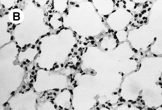 Fig. 4. Lung histopathology. Aspect of alveolar walls 60 minutes after IV injection of PBS (A) or 10 μg of MWReg30 (B); (C) 24 hours after IV injection of 10 μg of MWReg30; (D) vascular engorgement of septal capillaries with erythrocytes, 20 minutes after IV injection of 100 μg of MWReg30. (A through C) Hematoxylin/eosin staining of paraffin-embedded section (original magnification × 400). (D) Toluidine blue staining of Epoxy resin-embedded sections (original magnification × 1,000).