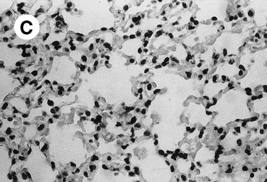 Fig. 4. Lung histopathology. Aspect of alveolar walls 60 minutes after IV injection of PBS (A) or 10 μg of MWReg30 (B); (C) 24 hours after IV injection of 10 μg of MWReg30; (D) vascular engorgement of septal capillaries with erythrocytes, 20 minutes after IV injection of 100 μg of MWReg30. (A through C) Hematoxylin/eosin staining of paraffin-embedded section (original magnification × 400). (D) Toluidine blue staining of Epoxy resin-embedded sections (original magnification × 1,000).