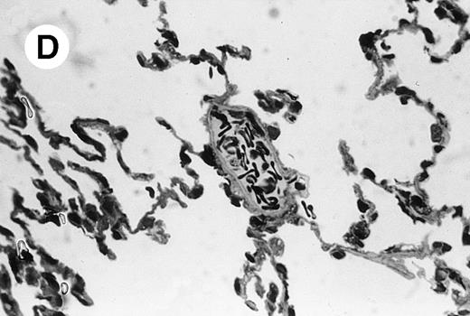 Fig. 4. Lung histopathology. Aspect of alveolar walls 60 minutes after IV injection of PBS (A) or 10 μg of MWReg30 (B); (C) 24 hours after IV injection of 10 μg of MWReg30; (D) vascular engorgement of septal capillaries with erythrocytes, 20 minutes after IV injection of 100 μg of MWReg30. (A through C) Hematoxylin/eosin staining of paraffin-embedded section (original magnification × 400). (D) Toluidine blue staining of Epoxy resin-embedded sections (original magnification × 1,000).