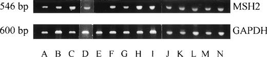 Fig. 2. Expression of MSH2 mRNA was investigated by RT-PCR in cases with abnormal MSH2 protein expression. A specific 546-bp band for MSH2 was detectable in A (EH), B (EW), C (KP), D (JG), F (MP), G (GMT), H (MT), I (NS), J (RG), K (SG), L (AH),M(AS), and N (BG). No MSH2 expression was found in E (MJ) (upper panel). A specific 600-bp band for GAPDH as a control was expressed in all of these samples.