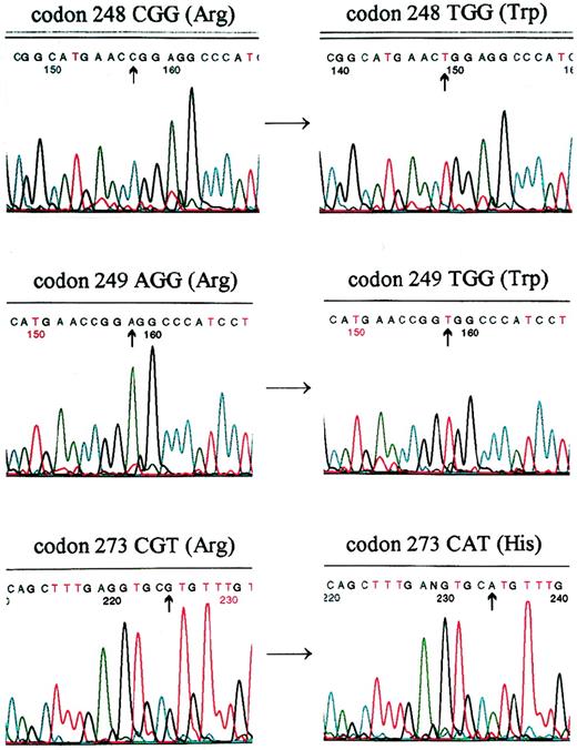 Fig. 4. Mutations of p53 were detected by direct sequencing in patients: AS (top), EW (middle), and JG (bottom). A cgg→tgg transition occurred in codon 248, resulting in Arg→Trp substitution in patient AS. A agg→tgg transversion occurred in codon 249, resulting in a Arg→Trp substitution in patient EW. A cgt→cat transition occurred in codon 273, resulting in a Arg→His substitution in patient JG.