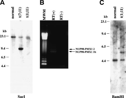 Fig. 1. (A) Southern blot analysis of the leukemia cell sample derived from t(1;11)(q23;p15) AML. Genomic DNA samples from the t(7;11)(p15;p15) AML patient as well as healthy control were also shown. Rearranged bands were detected both in t(1;11) patient as well as t(7;11) by Sac I digestion using a NUP98 probe. (B) 3′-RACE products of NUP98 fusion cDNA. MWM, 123-bp ladder molecular weight marker; RT(+), reverse transcribed and PCR-amplified patient poly(A)+ RNA sample; RT(−), patient RNA without reverse transcription. (C) Southern blot analysis of the patient genomic DNA with the 3′-fragment of shorter RACE product as a probe. Rearranged band was detected in patient sample digested withBamHI.