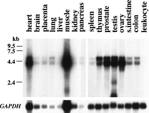 Fig. 4. Expression of PMX1 in human tissues. The gene is highly expressed in heart, skeletal muscle, thymus, prostate, testis, and ovary, although RNAs of heart and muscle were overloaded. No expression was detected in peripheral blood leukocytes.