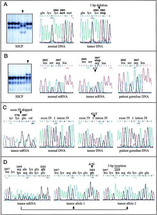 Fig. 1. Point mutations in the ATM gene in malignant B-cell lymphomas with (A, B, C) and without (D) monoallelic deletions of ATM. Mutations are indicated by arrowheads or by a bar. A, B-CLL-A: SSCP analysis of a 242-bp restriction fragment derived from the RT-PCR product containing exons 56-65 identified an aberrantly migrating fragment. DNA sequence analysis of the respective fragment showed 8412delA causing frameshift and truncation of the protein. DNA sequences of PCR amplified exon 59 are shown. (B) B-CLL-B: SSCP analysis of a 307-bp restriction fragment of the RT-PCR product encompassing exons 56-65 and DNA sequence analysis of the corresponding RT-PCR products identified the nonsense mutation 9139C>T (Arg3047ter). Note that the amount of cells with an 11q22-q23 deletion was 58% in the tumor sample, and therefore the signal intensity of the normal allele was unusually high. DNA sequence analysis of exon 65 from patient’s germline DNA showed absence of the mutation in the germ line. (C) MCL-A: The splice-donor site mutation in intron 59 (IVS59+1G>T), which causes skipping of exon 59 from the ATMtranscript and loss of 50 amino acids, was detected by DNA sequencing of the RT-PCR fragment containing exons 56-65 and by sequencing of PCR amplified exon 59 and its flanking intronic regions. The patient’s germ line DNA did not contain the mutation. (D) MCL-B: Cloning and subsequent sequencing of RT-PCR fragments harboring exons 51-57 allowed assignment of the two heterozygous mutations 7268A>G and 7250insGAA to two separate ATM transcripts. Thus, both alleles were affected by two independent mutations.