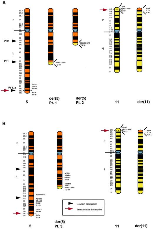 Fig. 4. Schematic representation of the rearranged chromosomes 5 and 11 in patients no. 1, 2 (A), and 3 (B). In each case, the normal chromosome homologue is shown on the left. The proximal breakpoints of the deletions are based on banding studies. In (A), the distal 5q deletion breakpoint and the 5q translocation breakpoint could not be distinguished: both were distal to NPM1. TheNPM1 gene sequence was deleted from the der(5), with theFLT4 sequence present, although translocated to the der(11). The 5q translocation breakpoint in (B) was also between theNPM1 and FLT4 genes. However, in this case, the 5q deletion was proximal to the translocation, with a distal breakpoint between the 5q31 probe and the ADRB2 gene (5q31.3). The 11p translocation breakpoint was the same in all 3 cases, between theHRC and RDPX1 genes on 11p15.5.