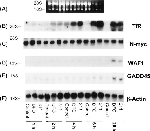 Fig. 8. The effect of incubation time (1 to 20 hours) with DFO (150 μmol/L) or 311 (25 μmol/L) on mRNA levels of the TfR, N-myc, WAF1, GADD45, mdm-2, and β-actin in BE-2 neuroblastoma cells. (I-A) Ethidium bromide staining of the agarose gel; (I-B) TfR; (I-C) N-myc; (I-D) WAF1; (I-E) GADD45; (I-F) β-actin. The result illustrated is a typical experiment from three experiments performed.