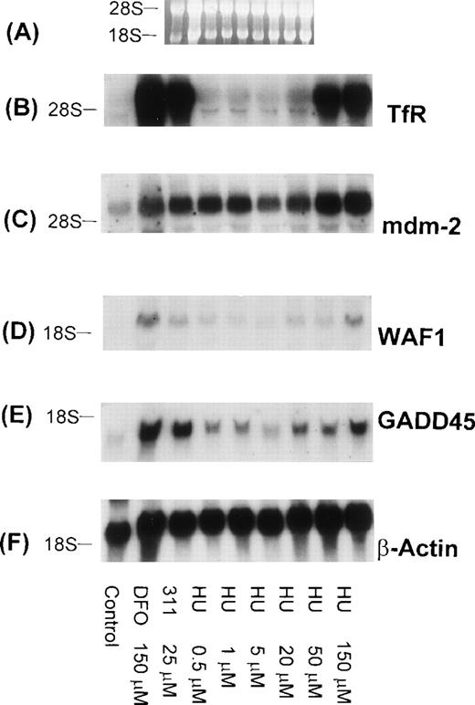 Fig. 11. The effect of the concentration of HU on mRNA levels of the TfR, mdm-2, WAF1, GADD45, and β-actin in BE-2 neuroblastoma cells. (A) Ethidium bromide staining of the agarose gel; (B) TfR; (C) mdm-2; (D) WAF1; (E) GADD45; (F) β-actin. The result shown is a typical experiment from two experiments performed.