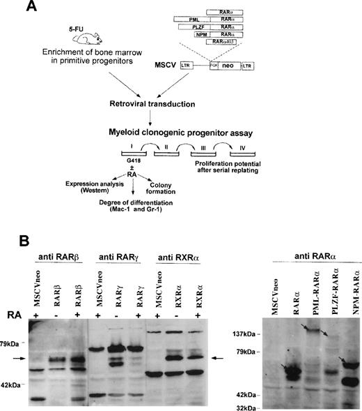 Fig. 1. Experimental strategy and protein expression in primary hematopoietic progenitors.(A) Scheme of the experimental approach used to study the effect of RAR-fusion genes on the proliferation and myeloid differentiation of the target cells and to evaluate the responsiveness of the transformed cells to retinoic acid. (B) Western blot analysis of cells transduced with the different vectors after 8 days of culture in methylcellulose (20 μg of protein was loaded per lane). When indicated, the cells were grown in the presence of RA (1 μmol/L). Arrows point to exogenously expressed proteins detected with the specific antihuman retinoid receptor antibodies indicated above each panel.