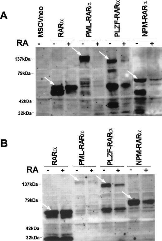 Fig. 7. RA induces the degradation of PML-RAR, PLZF-RAR, and NPM-RAR. (A) Western blot analysis of progenitors cultured in methylcellulose for 8 days in the absence or presence of RA (1 μmol/L) after transduction with RAR (15 μg of protein per lane), PML-RAR (30 μg of protein per lane), PLZF-RAR (40 μg of protein per lane), or NPM-RAR (20 μg of protein per lane). (B) Western blot analysis of cell lines established with RAR or RAR-fusion gene treated or not treated with RA (1 μmol/L) for 40 hours (20 μg of protein per lane). The transduced proteins are designated by the white arrows.