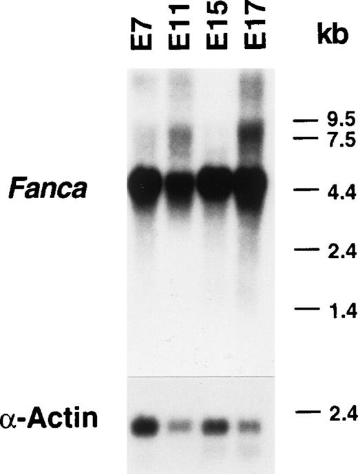 Fig. 1. Northern blot of poly A+ RNA from the developing mouse. A 742 bp fragment of mouse Fanca cDNA spanning exons 35 to 42 of the corresponding human FANCA gene and the human -actin cDNA were used as probes. The top blot was exposed for 4 days, whereas the bottom blot was exposed for 6 hours.