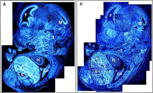 Fig. 6. Global expression of Fanca at E13.5 of mouse development. Reconstruction image of a whole embryo at E13.5 from multiple sections visualized with (A) antisense and (A′) sense probes. F, forebrain; H, heart; L, liver; Lu, lung; M, midbrain; S, stomach.
