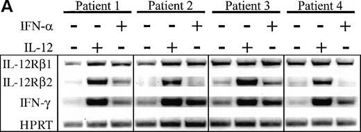 Fig. 4. Enhancement of IL-12Rβ2 and IFN-γ transcript expression in HIV-infected PBMC by IL-12 and IFN-. PBMC from eight patients were cultured at 2 × 106/mL for 72 hours with 2 μg/mL PHA ± 2 ng/mL IL-12 or 1,000 U/mL IFN-. (A) RNA was extracted and RT-PCR was performed for the detection of IL-12Rβ1, IL-12Rβ2, IFN-γ, and HPRT mRNA. Representative results from 4 of 8 donors are shown. (B) Densitometric values were assigned to bands by ImageQuaNT, normalized to HPRT values, and displayed as fold induction of message levels compared with PHA stimulation alone. Data points are from individual donors (n = 8) and the mean is represented by (+).