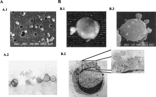 Fig. 3. Microscopy analysis of released vesicles (A) and their cellular generation (B). (A) Cell-free SN obtained from GC B cells cultured for 2 hours was passed through a filter (0.1-μm pore), and the filter was processed for scanning (A.1) and transmission (A.2) EM. Filter pores are seen as black holes in A.1. (B) GC B cells were stained with PKH26-GL and, after 2 hours, were analyzed under fluorescence microscopy (B.1). GC B cells cultured for 2 hours were studied by transmission EM (B.2) and scanning EM (B.3).