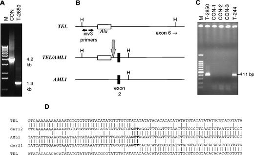 Fig. 1. Analysis of TEL/AML1 translocations in concordant twin leukemias. (A) Long-distance inverse PCR analysis of an intron 5TEL HindIII fragment of normal control (CON) and leukemic (T-2850) DNA. The expected band size is 4.2 kb, patient T-2850 exhibited a 1.3-kb band. (B) Schematic of the normal TEL andAML1 genes along with the TEL/AML1 translocation in T-2850. The inv3 primers anneal to the 5′ end of the 4.2-kbHindIII fragment as shown; the translocation brought aHindIII site of AML1 closer to the inv3 primer sites than the normal HindIII site in TEL. The location of anAlu repeat sequence in TEL is shown, as well as exon 2 of AML1. A large arrow indicates the translocation breakpoint. (C) PCR analysis of the reciprocal AML1/TEL translocation in the twins. The 411-bp heminested PCR product was amplified in both twins, but not in control DNA samples. A total of 10 ng of T-2850 and 1 μL of a 1:100 dilution of DNA isolated from the T-244 slide was amplified, along with 50 ng of control DNA samples. CON-1 is DNA from a normal healthy individual, CON-2 and CON-3 are DNA samples from other pediatric leukemia patients that also had TEL/AML1translocations by RT-PCR. (D) Sequence surrounding the translocations in the twins. Normal TEL is shown at top and bottom andAML1 in the center. TEL/AML1 is indicated by der 12 andAML1/TEL by der 21. The duplicated “GTT” at the breakpoint site is shown in bold, a Y is shown at the center nucleotide in the der 21 sequence to indicate the T → C mutation in T-244. The bottom sequence of TEL is shifted 44 nucleotides to the left to indicate a 47-bp deletion on translocation.