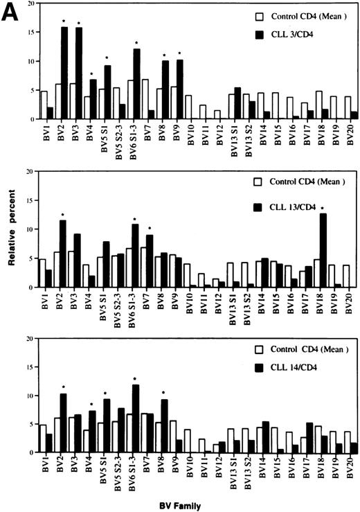 Fig. 2. Relative TCRBV gene segment usage of three representative CLL patients compared with the mean control values for CD4 (A) and CD8 (B) T-cell subsets. *Indicates a statistically significant overexpression as defined in Table 4.