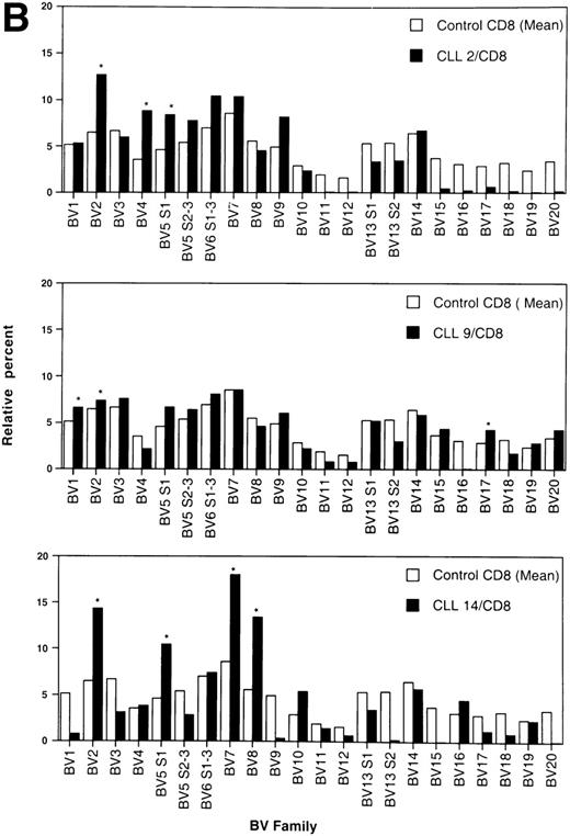 Fig. 2. Relative TCRBV gene segment usage of three representative CLL patients compared with the mean control values for CD4 (A) and CD8 (B) T-cell subsets. *Indicates a statistically significant overexpression as defined in Table 4.