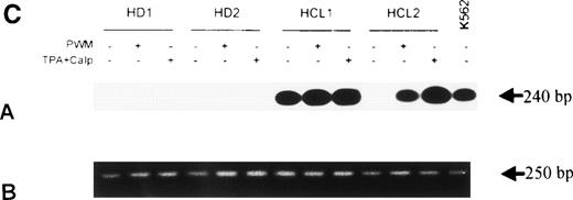 Fig. 4. (A) Expression of bFGF-specific mRNA. PBMC from HDs (n = 4) and patients suffering from HCL (n = 4) were subjected to RNA isolation immediately after separation by gradient centrifugation. After RT-PCR amplification using bFGF-specific primers and Southern blotting, positive reactions were visualized by hybridization with a DIG-labeled bFGF cDNA probe followed by autoradiography. Negative control: no cDNA added; K562 mRNA served as positive control. In parallel experiments, β-actin expression was analyzed by RT-PCR to ensure that identical amounts of cDNA are used (not shown). (B) Synthesis of bFGF protein. PBMC derived from HCL patients (n = 3) and HD (n = 3) were analyzed for intracellular bFGF. A total of 2 × 106 cells were lysed and bFGF was determined by ELISA. Data are shown as mean values (HD, 7 pg/mL; HCL, 420 pg/mL). (C) Activation of bFGF-specific mRNA. PBMC from HDs (n = 2) and HCL patients (n = 2) were cultured for 48 hours in medium or stimulated with either PWM (10 μg/mL) or TPA (10 ng/mL) + Ca-Ip A23187 (10 ng/mL) (TPA+Ca-Ip). After RNA isolation, RT-PCR, Southern blotting, and hybridization with a DIG-labeled bFGF, cDNA-positive reactions were visualized by autoradiography (a). K562 mRNA served as positive control. (b) Shows results of β-actin–specific RT-PCR.