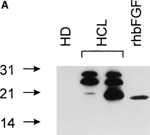 Fig. 5. (A) Intracellular bFGF expression pattern of PBMC from HCL patients. A total of 30 μL of cell lysates (2 × 106cells/mL) were separated by SDS-PAGE, blotted, and analyzed by Western blotting. PBMC from HCL expressed three bFGF isoforms (approximately 18, 23, and 25 kD), while no bFGF could be detected in HD. rhbFGF was used as control. (B) Release of a 23-kD bFGF isoform. CM from HD and HCL cultures was harvested after 48 hours, subjected to heparin chromatography, and bulk eluted fractions were separated by SDS-PAGE. Proteins were transferred onto nitrocellulose and analyzed by Western blotting. rhbFGF served as a positive control.