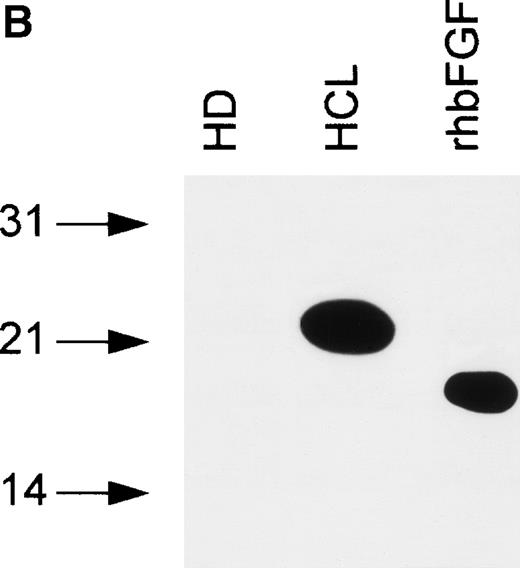 Fig. 5. (A) Intracellular bFGF expression pattern of PBMC from HCL patients. A total of 30 μL of cell lysates (2 × 106cells/mL) were separated by SDS-PAGE, blotted, and analyzed by Western blotting. PBMC from HCL expressed three bFGF isoforms (approximately 18, 23, and 25 kD), while no bFGF could be detected in HD. rhbFGF was used as control. (B) Release of a 23-kD bFGF isoform. CM from HD and HCL cultures was harvested after 48 hours, subjected to heparin chromatography, and bulk eluted fractions were separated by SDS-PAGE. Proteins were transferred onto nitrocellulose and analyzed by Western blotting. rhbFGF served as a positive control.