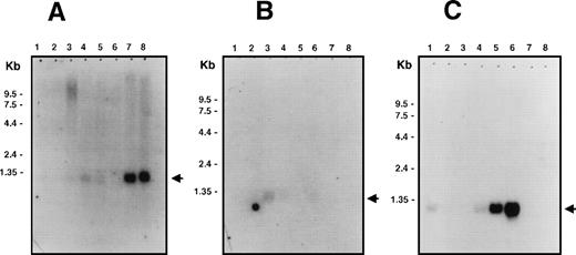 Fig. 1. Multiple tissue Northern blot analysis for Bik/Nbk expression. PolyA+ RNA (2 μg) were loaded per lane. Arrows indicate the position of the 1.1 kb Bik/Nbk transcript. (A) Multiple human tissue Northern blot analysis. Lane 1, heart; 2, brain; 3, placenta; 4, lung; 5, liver; 6, skeletal muscle; 7, kidney; 8, pancreas. (B) Lane 1, spleen; 2, thymus; 3, prostate; 4, testis; 5, ovary; 6, small intestine; 7, colon; 8, peripheral blood leukocytes. (C) Human cell lines Northern blot analysis. Lane 1, promyelocytic leukemia HL60; 2, cervix carcinoma HeLa S3; 3, erythroid leukemia K562; 4, T-cell leukemia MOLT4; 5, type III Burkitt lymphoma Raji; 6, colorectal adenocarcinoma SW480; 7, lung carcinoma A549; 8, melanoma G361.