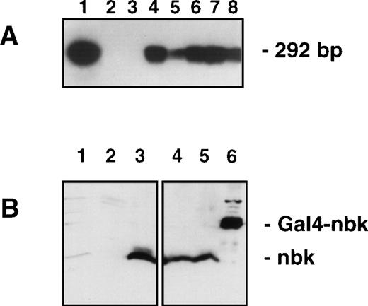 Fig. 2. Analysis for Bik/Nbk expression in transfected H9 T-lymphoma cells. (A) RT-PCR and Southern blot: The exogenous mRNA transcript was detected by RT-PCR with primers designed to vector specific forward sequence and Bik/Nbk specific reverse sequence, yielding a 292-bp fragment. DNA was electrophoresed, Southern blotted and hybridized by the use of a third, radiolabeled oligonucleotide specific for the 5′ terminus of Bik/Nbk. Positive and negative controls were pCIN.Nbk plasmid (lane 1) and water (lane 2). Lane 3, H9 3D8 control transfected cells; lane 4, clone no. 2; lane 5, clone no. 7; lane 6, clone no. 10; lane 7, clone no. 13; lane 8, clone no. 16. (B) Western blot analysis for Bik/Nbk expression: Protein extracts from SW480 colon carcinoma cells (lane 1), H9 3D8 control cells (lane 2) or Bik/Nbk transfected clones no. 2 (lanes 3 and 4) and 10 (lane 5) were separated by SDS-polyacrylamide gel electrophoresis and Western blot analysis with a goat antiserum against Bik/Nbk. Yeast expressed Bik/Nbk Gal4-Nbk fusion protein served as a positive control (lane 6). Bands were visualized by means of ECL.