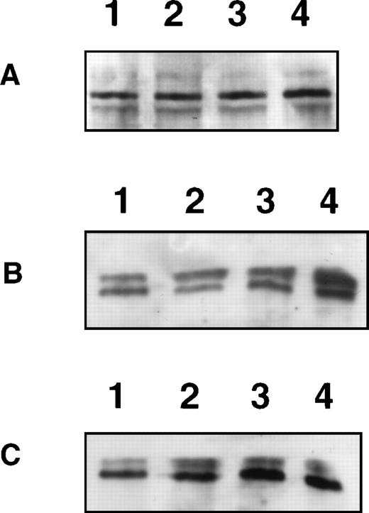Fig. 5. Expression and induction of the GR in H9 cells. (A) Western blot analysis for GR- (95 kD, upper band) and GR-β (90 kD, lower band) expression. Lane 1, H9 3D8 cells; lane 2, H9 Bik/Nbk clone no. 16, lane 3, clone no. 10; lane 4, clone no. 2. (B) Western blot analysis for induction of GR expression by dexamethasone in H9 3D8 cells. Lane 1, medium control; lane 2, 24-hour culture in the presence of dexamethasone (10−6 mol/L); lane 3, 48 hours; lane 4, 72-hour induction. (C) Induction of GR expression by dexamethasone in H9 Bik/Nbk clone no. 16. Lane 1, medium control; lane 2, 24-hour culture in the presence of dexamethasone (10−6 mol/L); lane 3, 48 hours; lane 4, 72 hours.